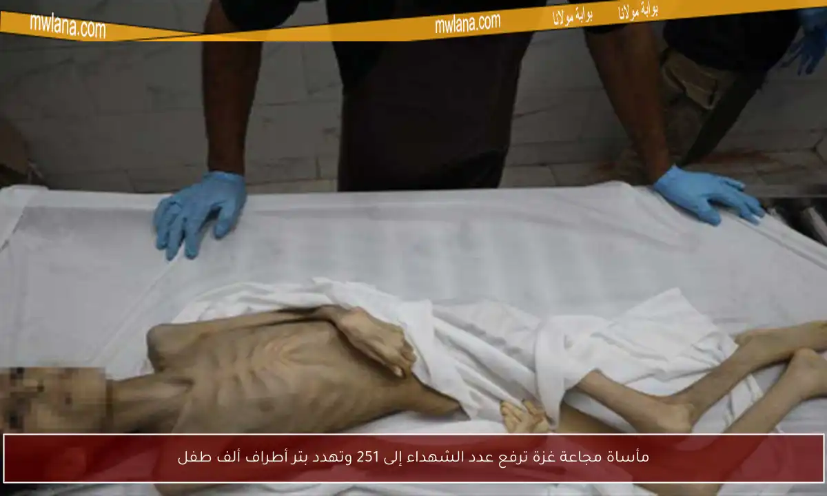 مأساة مجاعة غزة ترفع عدد الشهداء إلى 251 وتهدد بتر أطراف ألف طفل
